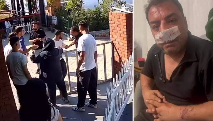 Turistlerden 4 fotoğraf için servet istediler, kavgada araya giren şoförün burnunu kırdılar