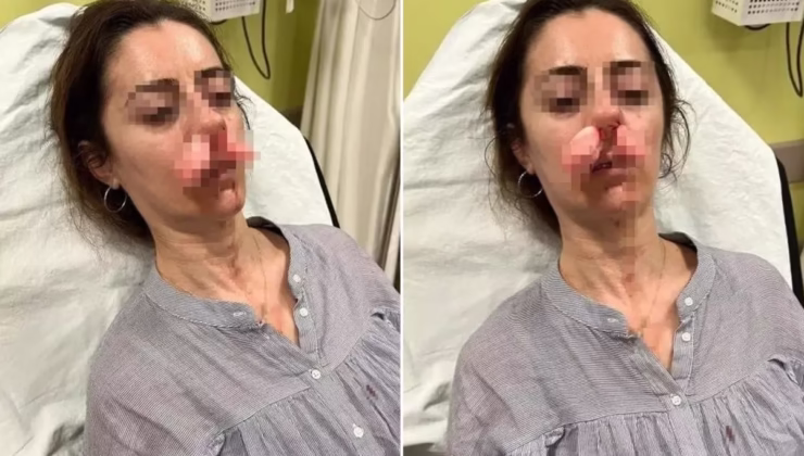 Kocasının sevgilisi zannedip öldüresiye darp etmişti! Arabanın kapısı silah sayıldı