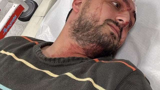 Otizmli genci “odunluğa baktı” diye darbeden fırın çalışanı tutuklandı