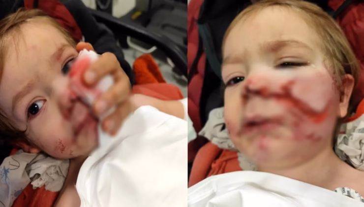 Pitbull saldırısına uğrayan minik Efe’den haber var!